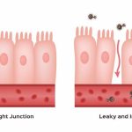 Sindrome dell’Intestino Permeabile: cause, sintomi e soluzioni