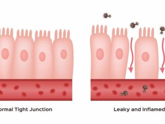Sindrome dell’Intestino Permeabile: cause, sintomi e soluzioni